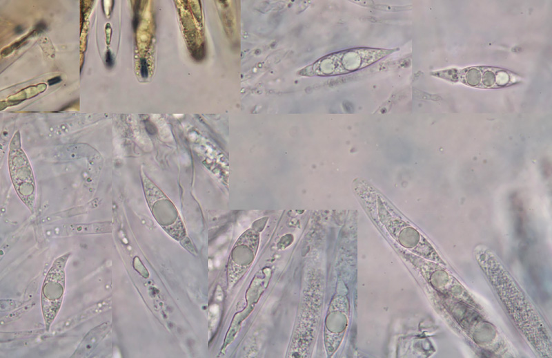 Alloanthostomella rubicola mikro